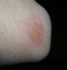 elbow.jpg